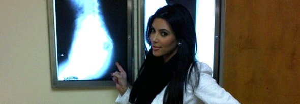 kim kardashian butt xray
